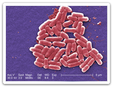 Escherichia coli O157:H7 (<em>E. coli</em>)