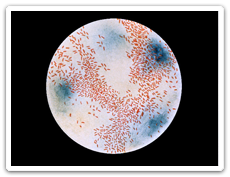 Photomicrograph of Haemophilus influenzae