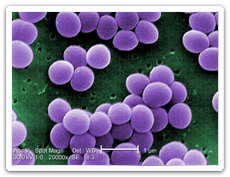 Staphylococcal Food Intoxication (Staphylococcus aureus)